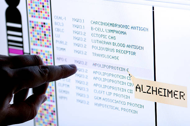 sindrome da malattia di alzheimer - microarray foto e immagini stock