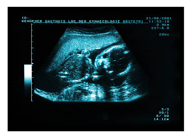 istock Baby Ultrasound Echo 186842771