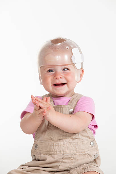 Baby Helmet Baby girl wearing a helmet for treatment of plagiocephaly plagiocephaly stock pictures, royalty-free photos & images