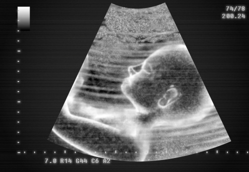 7-month fetus ultrasound