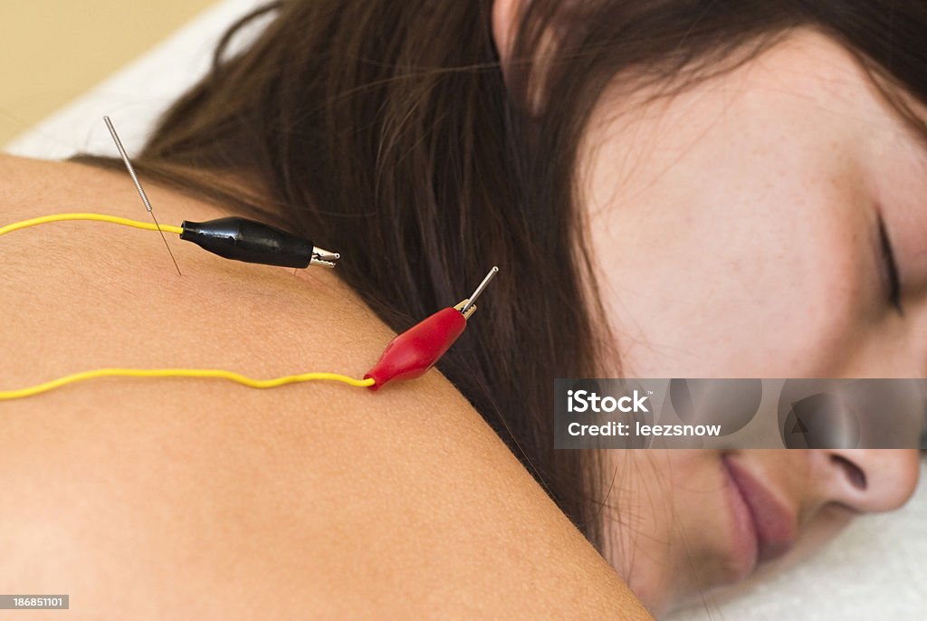 전기 자극 요법이란-침술용 시리즈 - 로열티 프리 전극 스톡 사진