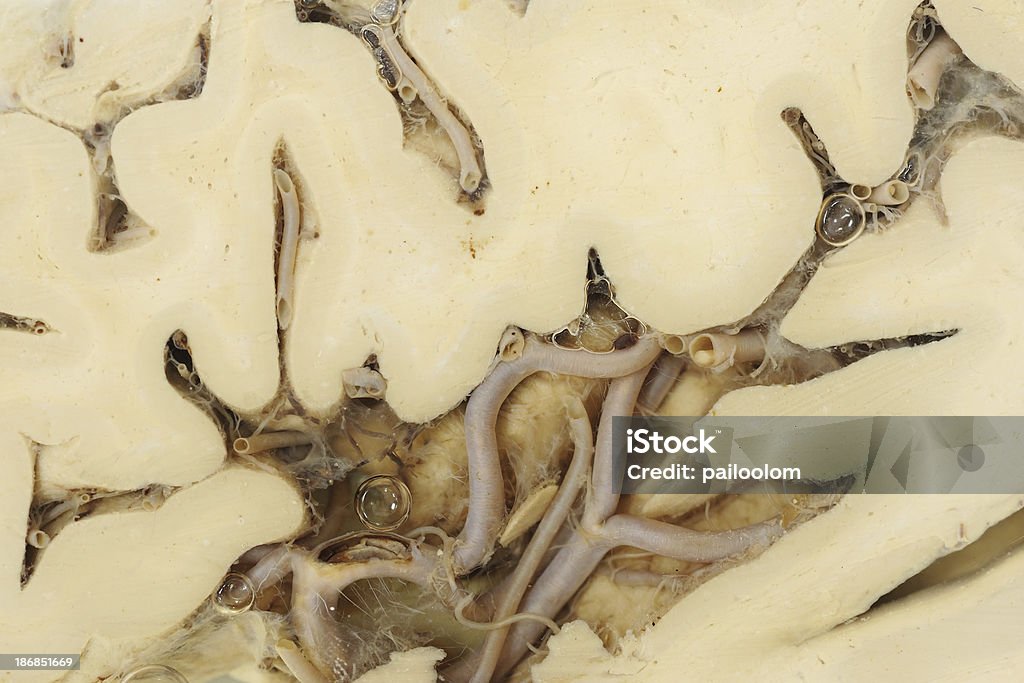 Real cervello umano - Foto stock royalty-free di Anatomia umana