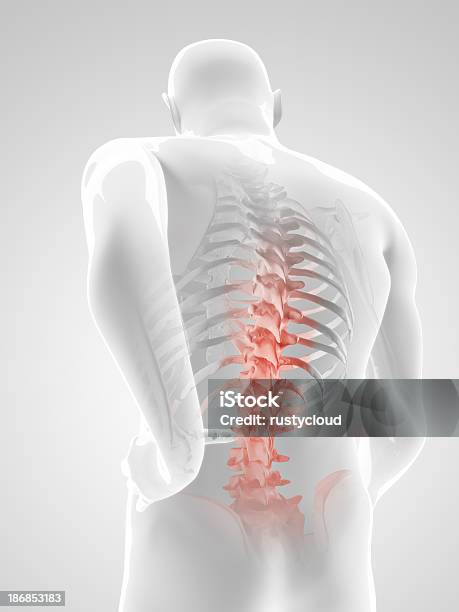 Back Pain Illustrationen Stockfoto und mehr Bilder von Rückenschmerzen - Rückenschmerzen, Anatomie, Arthritis