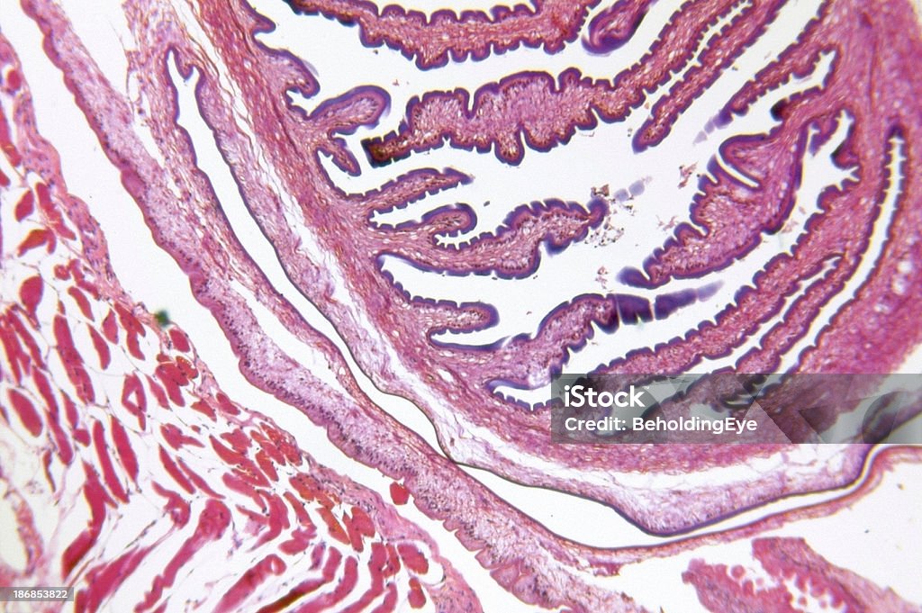 Parassita della Cysticercus Encysted di maiale Muscolo - Foto stock royalty-free di Maiale - Ungulato