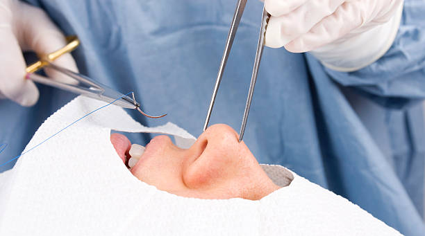 Close-up of gloved Doctor doing surgical procedure on a nose stock photo