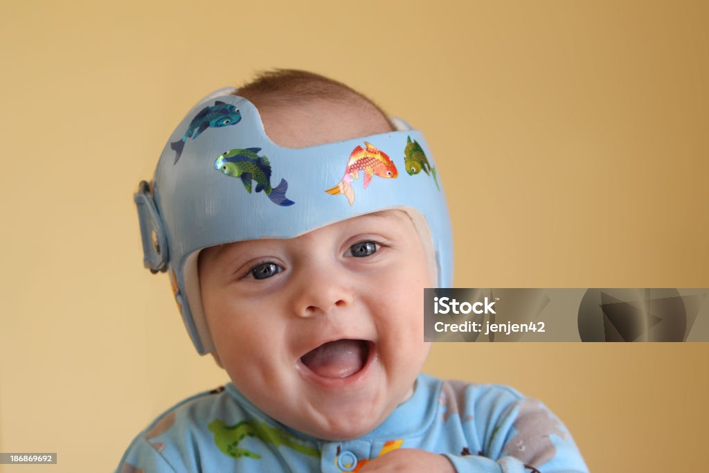 Plagiocephaly soin - Photo de Bébé libre de droits