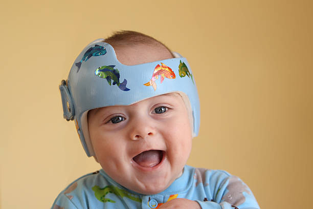 A happy baby boy getting plagiocephaly treatment Infant wearing a helmet or band for treatment of plagiocephaly (Shallow depth of field. Focus on child's eyes.)SEE ALSO: plagiocephaly stock pictures, royalty-free photos & images
