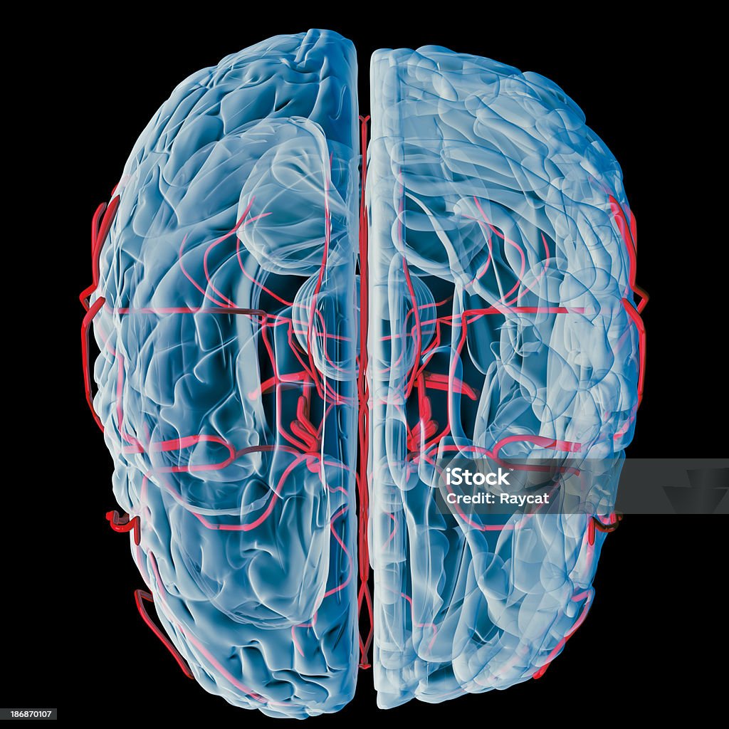 Cérebro com bloodvessels raio-x (Superior - Foto de stock de Vaso sanguíneo royalty-free