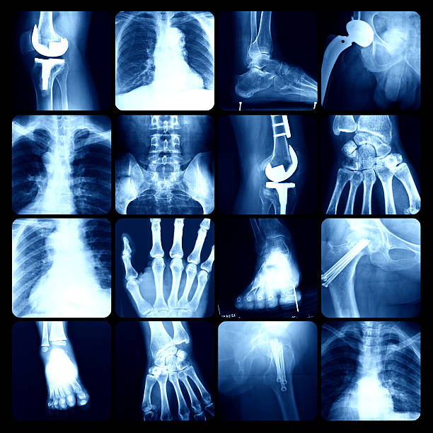 x-ray - bending human foot ankle x ray image stock-fotos und bilder