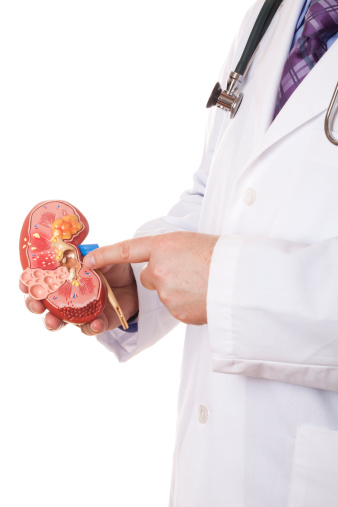 Doctor with stethoscope on his neck pointing to urinary stones on the anatomical model of human kidney. White background.