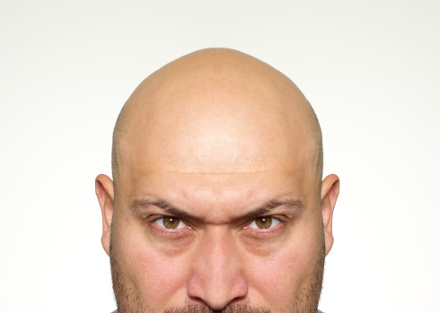 Angry bald man