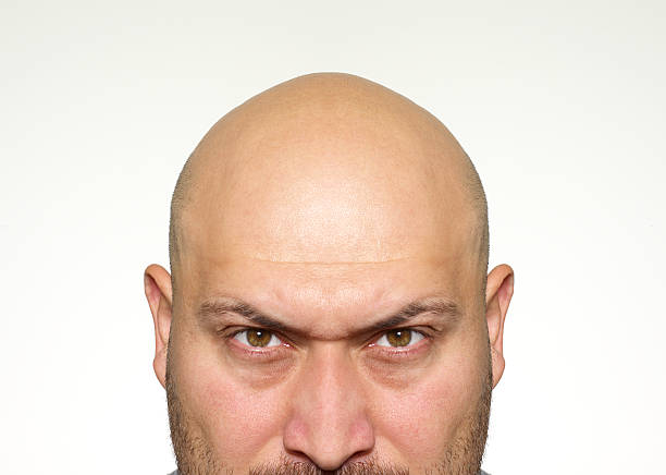 Angry bald man Angry bald man skinhead haircut stock pictures, royalty-free photos & images