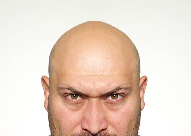 577 Ugly Bald Men Stock Photos, Pictures & Royalty-Free Images - iStock 577 Ugly Bald Men Stock Photos, Pictures & Royalty-Free Images - iStock
