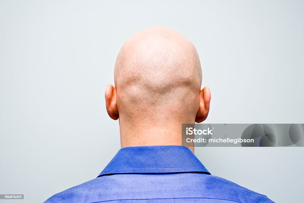 Parte posterior de un hombre calvo cabeza - Foto de stock de Calvo libre de derechos