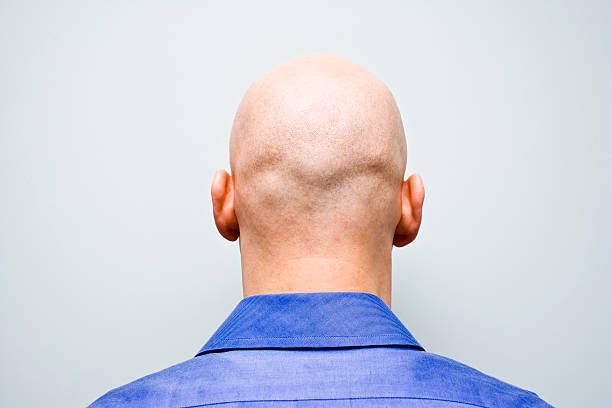 Back of man's bald head Man stands in a blue shirt facing a light blue wall showing his bald head at the camera completely bald stock pictures, royalty-free photos & images
