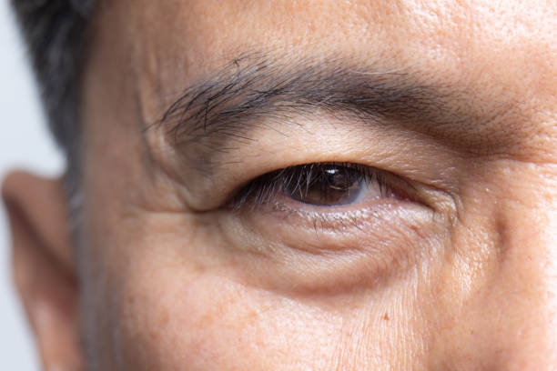 Senior man eyestrain after for long stretches at computer or digital screens. stock photo