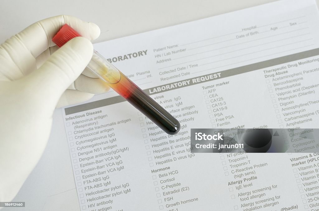 Próbki krwi - Zbiór zdjęć royalty-free (Analizować)