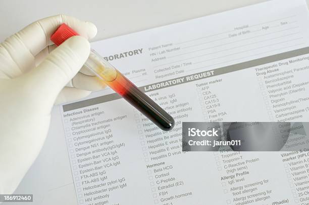 Próbki Krwi - zdjęcia stockowe i więcej obrazów Analizować - Analizować, Badania, Badania kliniczne