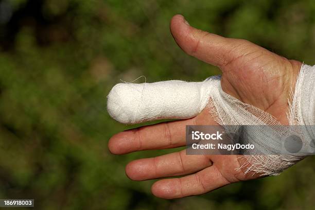 Branco Medicamento Rápido Em Lesões Mão Humana Com O Dedo - Fotografias de stock e mais imagens de Acidente - Conceito