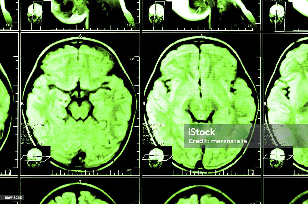 X-ray image du cerveau calculé tomography - Photo de Aimant libre de droits