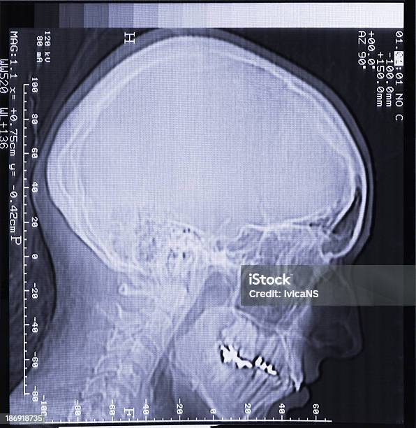 Magnetic Resonance Scan Of Human Head Stock Photo - Download Image Now - Anatomy, Data, Gyrus