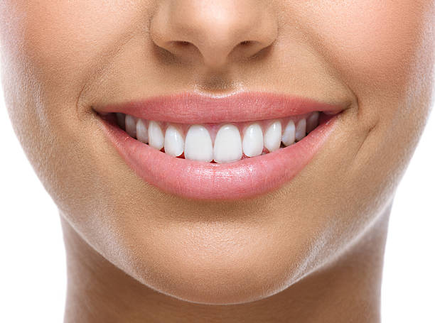 closeup of smile with white teeth - teeth stockfoto's en -beelden