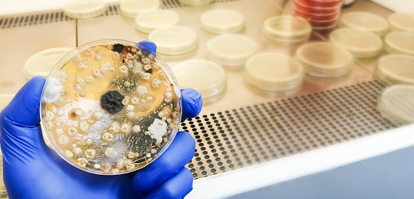 The researcher is holding Petri dish plate with Malt Extract Agar use for growth media to isolate and cultivate yeasts, molds fungal in medical health laboratory analysis disease