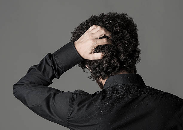 Dandruff Man's shoulders full of dandruff dandruff men stock pictures, royalty-free photos & images