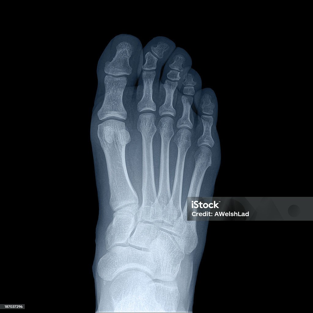 x-ray homem de pé direito-Vista de Cima - Royalty-free Raio X Foto de stock