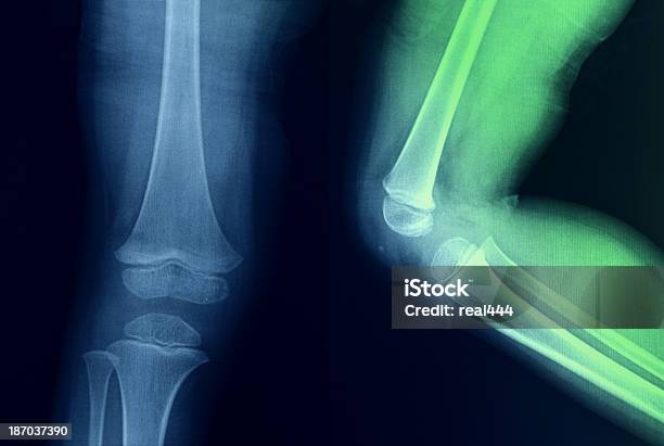 Joelho Humano Anatomia Uma Radiografia De Ossos Da Perna - Fotografias de stock e mais imagens de Anatomia