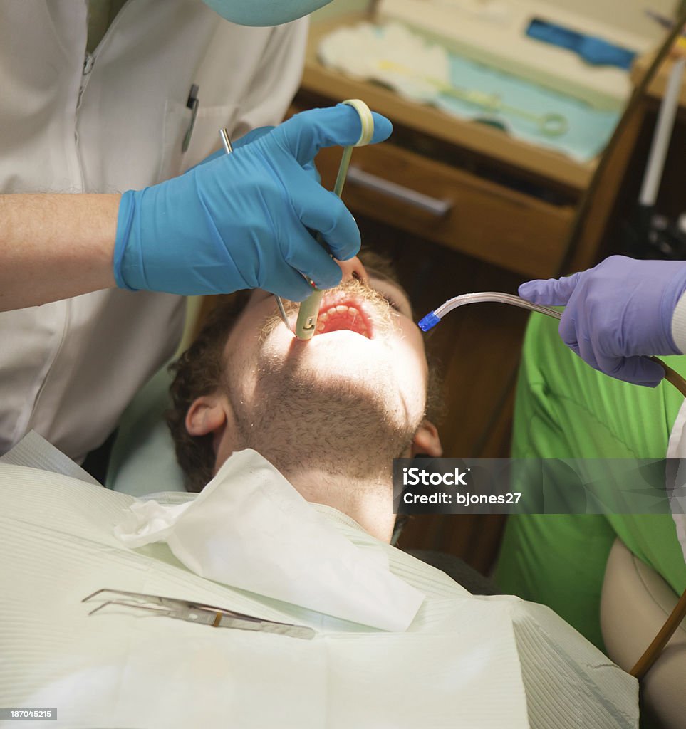 若い男性の歯科医院のあるトゥース充填、 - 3人のロイヤリティフリーストックフォト