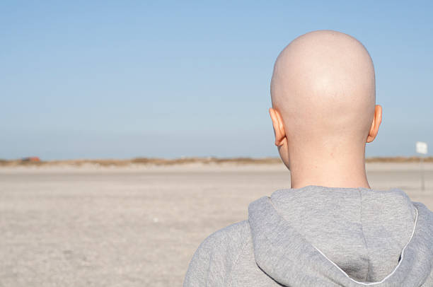 Woman with bald head looking into distance stock photo