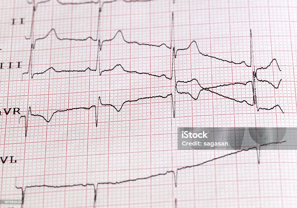 cardiogram - Photo de Horizontal libre de droits