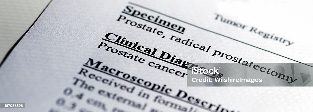 La diagnosi di carcinoma prostatico - Foto stock royalty-free di Cancro alla prostata