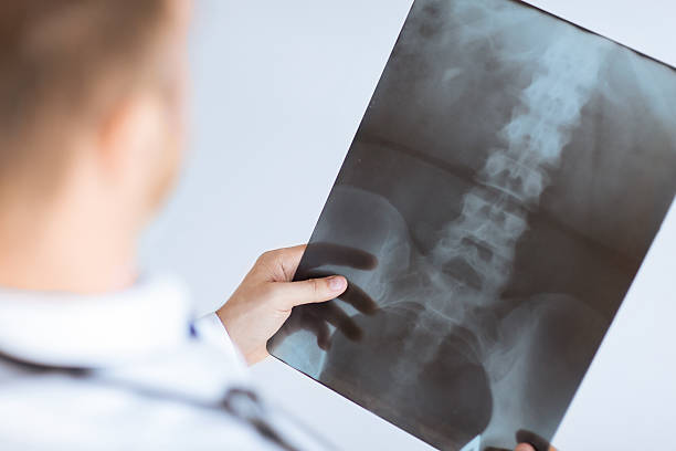 istock doctor holding x-ray or roentgen image 187104506