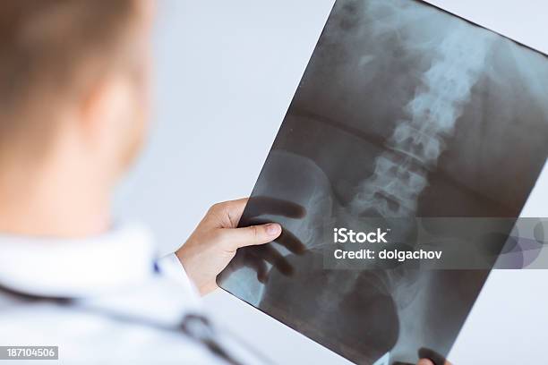 Doctor Holding Xray Or Roentgen Image Stock Photo - Download Image Now - Adult, Anatomy, Close-up
