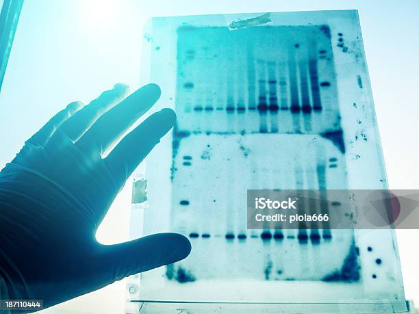 遺伝子になる Dna 分析結果 - DNA鑑定のストックフォトや画像を多数ご用意 - DNA鑑定, 電気泳動実験, DNA