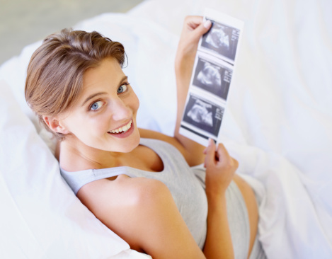 A high-angle view of a pregnant woman looking up at the camera while holding a sonogram picture