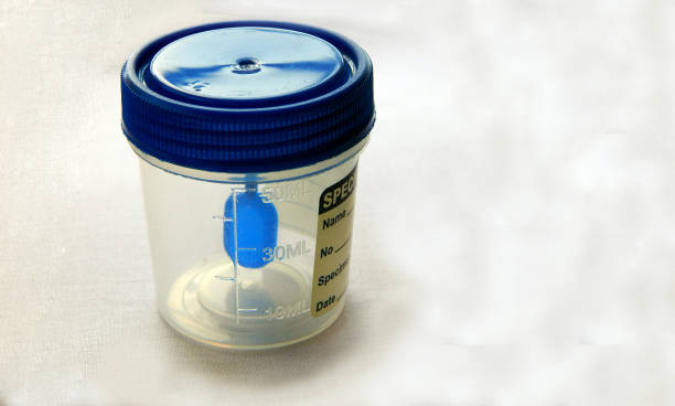 istock view of  empty plastic container for taking stool or feces samples of patient in pathology laboratory 1871795948