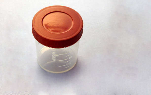 istock view of  empty plastic container for taking urine samples of patient in pathology laboratory 1871797514