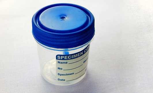 Close-up view of  empty plastic container for taking stool or feces samples of patient in pathology laboratory