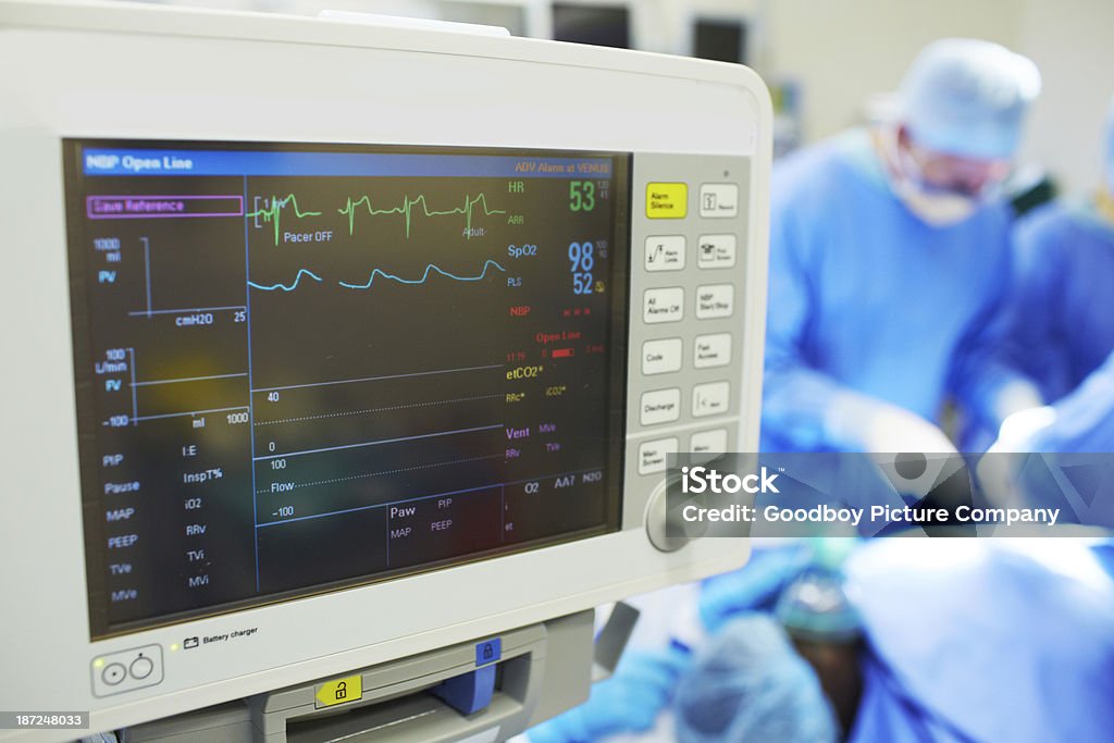 Keeping track of the patient's vitals Cropped view of a heart monitor giving vital sign readings during an operation Electrocardiography Stock Photo