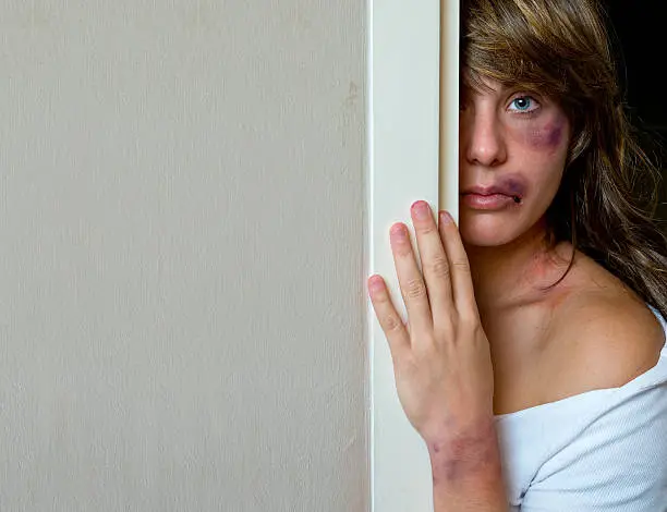 woman with bruises victim of domestic violence or accident hiding behind wall