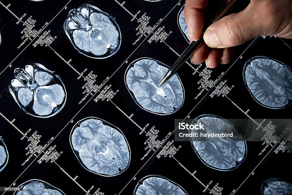 Scanner à résonance magnétique de cerveau tête crâne et os avec Main pointant du doigt - Photo de Image par résonance magnétique libre de droits