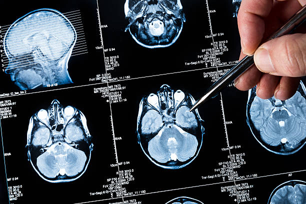 Brain scan being viewed by a doctor stock photo