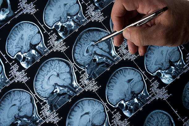 mri 脳スキャンの頭とスカル、指を指す手 - 脳外科手術 ストックフォトと画像
