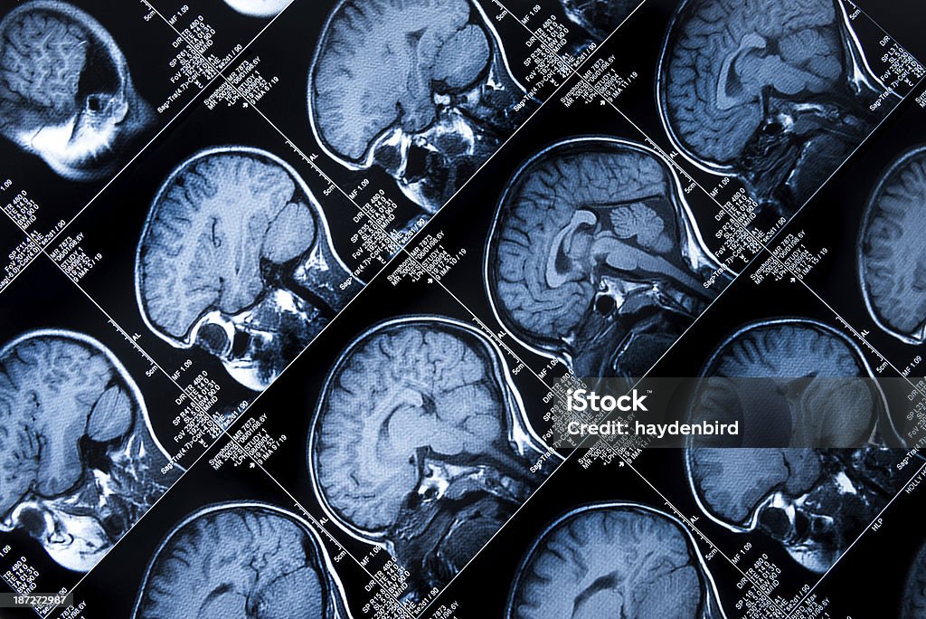 Cerveau montrant Scanner à résonance magnétique plusieurs images de la tête et du crâne - Photo de Scanographie libre de droits