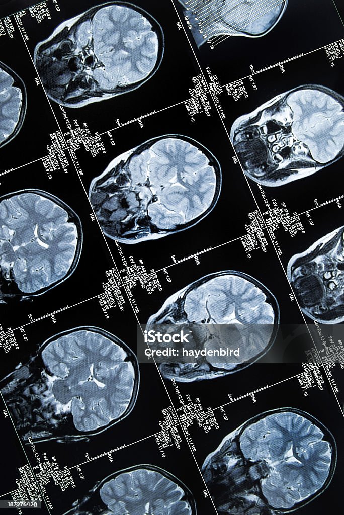 Cerveau montrant Scanner à résonance magnétique plusieurs images de la tête et du crâne - Photo de Anatomie libre de droits