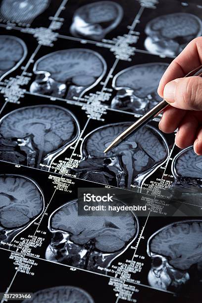 Foto de Mri Cérebro Exame Da Cabeça E Crânio Com Mão Apontando e mais fotos de stock de Exame de ressonância magnética