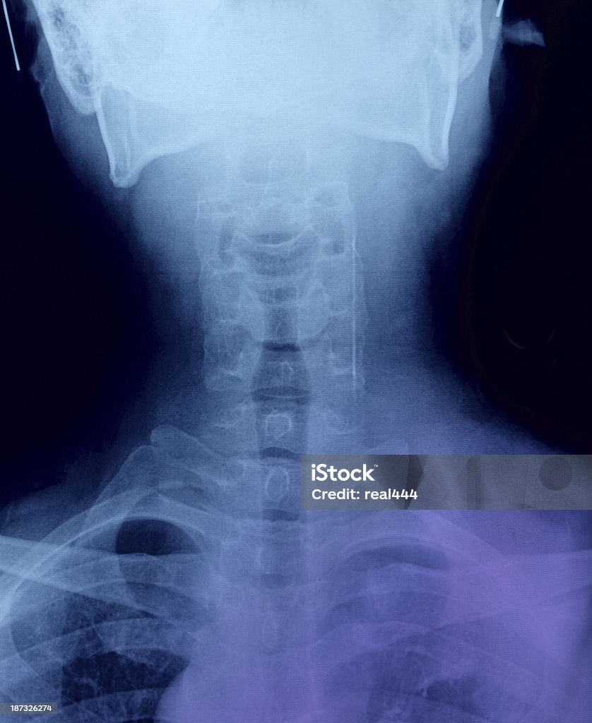 X-ray image Adult Stock Photo